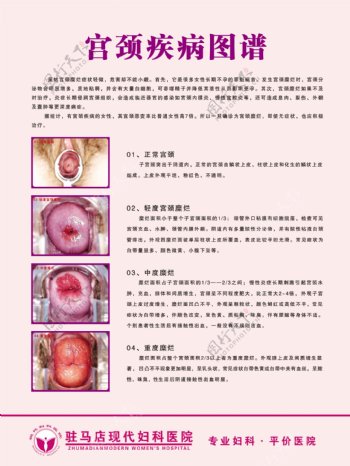 宫颈疾病图谱图片