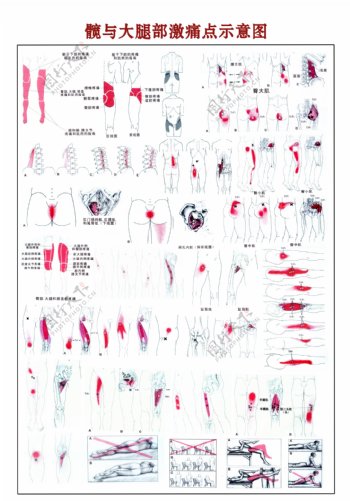 髋与大腿部激痛点示意图