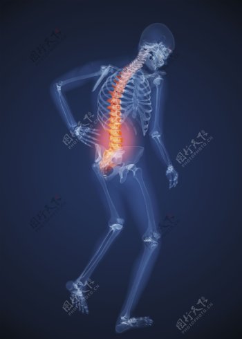 人体背部X光透视图图片