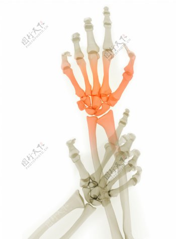 双手X光图像图片