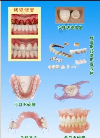牙科宣传单海报图片