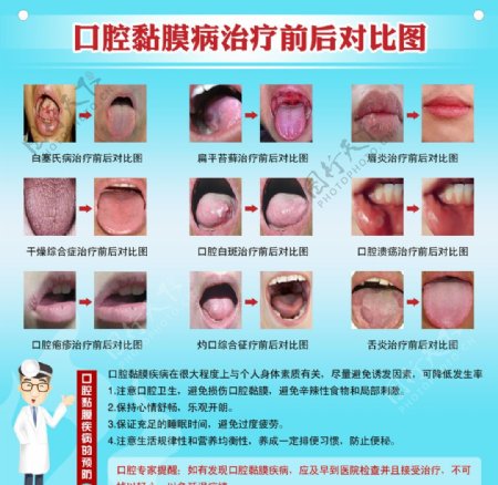 口腔疾病图片
