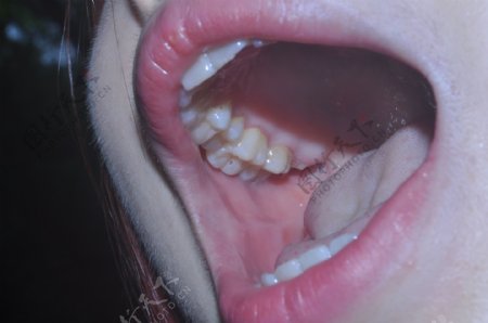 牙齿图片