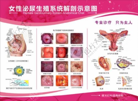 女性泌尿生殖系统解剖示意图