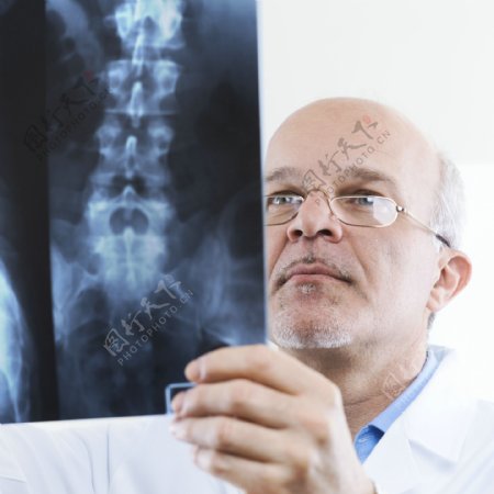 拿脊椎骨x光片的男医生图片
