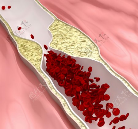 大肠器官图片
