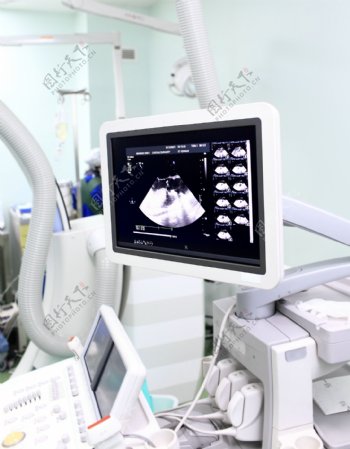 超声波里面的胎儿影像图片