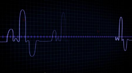 高科技仪表检测心脏速率显示器医疗