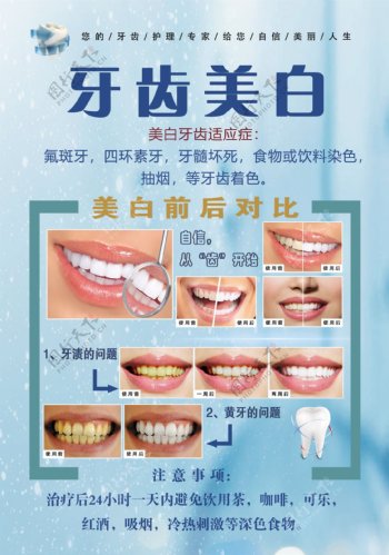 牙齿美白宣传海报